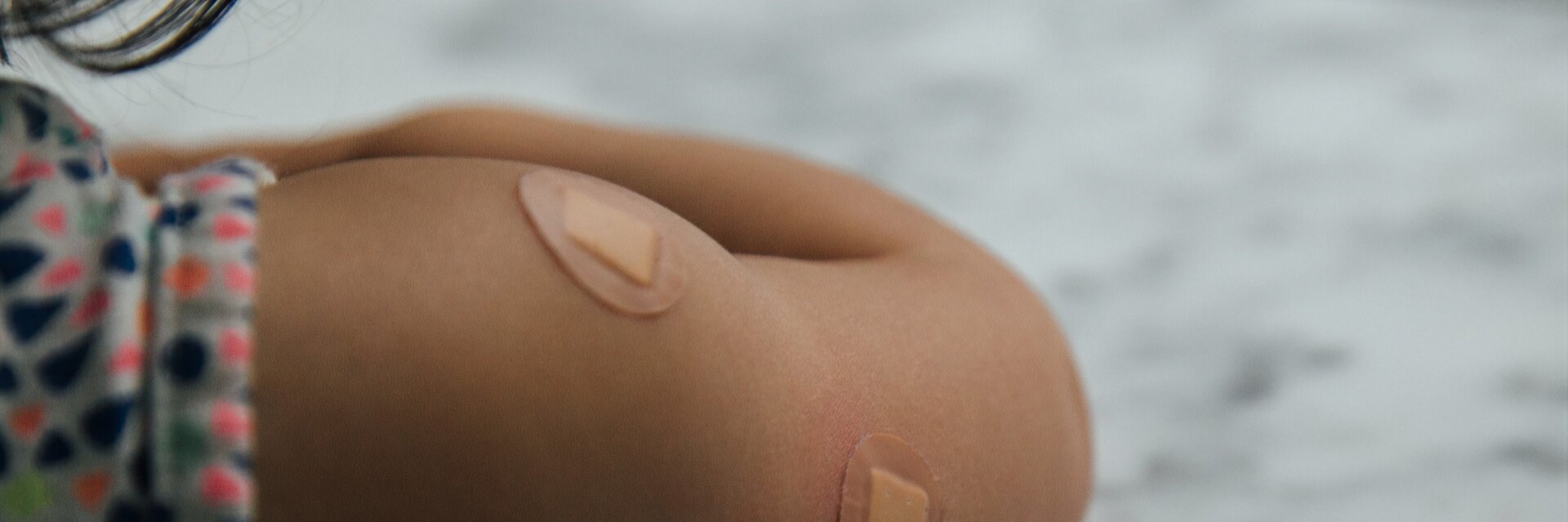 Auf einem Kinderoberarm sind Pflaster von einer Impfung zu sehen