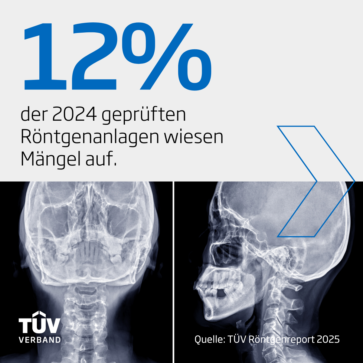 Grafik: 12% der 2024 geprüften Röntgengeräte wiesen Mängel auf. Quelle: TÜV Röntgenreport 2025.
